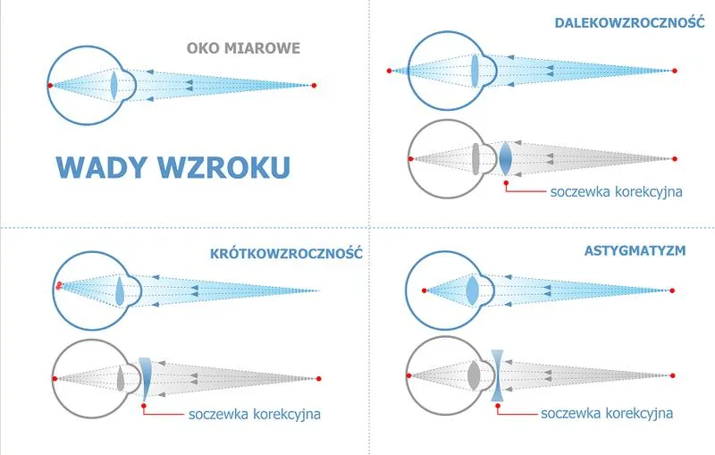 Wady wzroku
